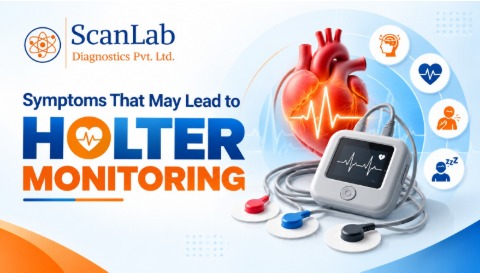 Holter Monitoring